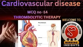 Top 50 MCQ on Cardiovascular system ( Thrombolytic therapy) Osssc Nursing officer . QRS Nursing 