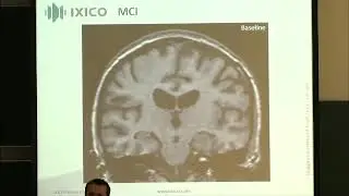 Multiple Speakers | Imaging biomarkers in Alzheimer's Disease: the technical and regulatory......