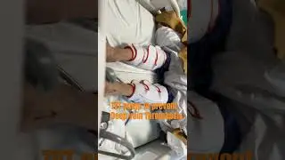 DVT pump #thrombosis #viralshort #shortsvideo #trending #physiotherapy #physioanjana