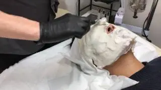 Environ Chemical Peel