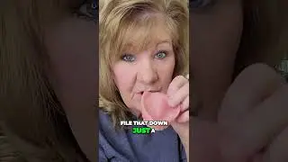 Easy DIY Fix for Denture Discomfort   Get Immediate Pain Relief! #immediatedentures