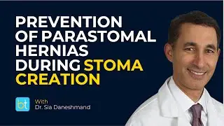 Best Practices in Stoma Creation to Prevent Parastomal Hernias | BackTable Urology Clips