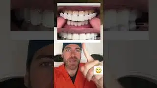 Un dentier &agrave; faire tout seul &agrave; la maison! #shorts