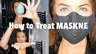 How to get rid of MASKNE | Blemishes & spots from wearing face masks!