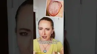 Tongue Diagnosis in TCM #chinesemedicine