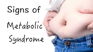 METABOLIC SYNDROME