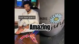 Amazing            #duet #doctor #feet #fascitis #anatomy