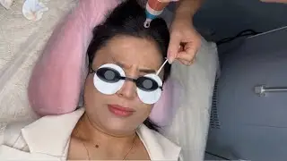 Eyebrow tattoo removal (4)