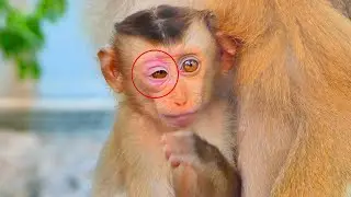 So S-a-d....Baby Monkey SACKY Got S-wollen And P-ainful On His Eyes