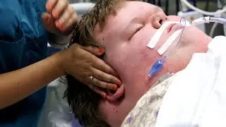At 715 Pounds He Was The Heaviest Teen In The World, Here&rsquo;s How He Turned His Life Around