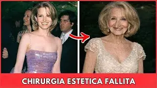7 attrici di Hollywood un tempo bellissime rovinate dalla chirurgia estetica