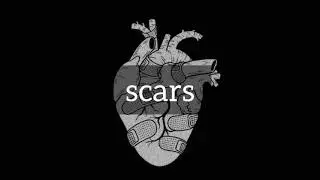 FREE Sad Type Beat - 