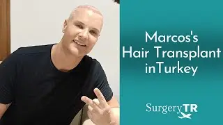 Hair Transplant | Marcos's Experiences | SurgeryTR