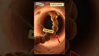 ai realistic video aboutconstipation movement insidehuman digestive system#3danatomy #animation