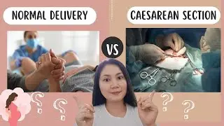 NORMAL Delivery VS CAESAREAN Section || What are the Pros & Cons?@renaflorasiolipasan #pregnancy