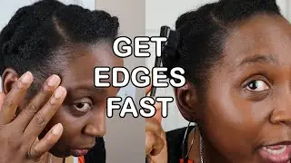 How to Get Hide Balding Edges Fast |  DiscoveringNatural