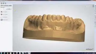 How to scan a BiteGuard Models and prepare virtual bases