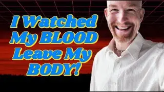 I Watched My BLOOD Leave My BODY! (Chronic Pain, Anxiety & Mindbody Healing)
