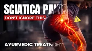 Sciatica Pain क्यों होता है? | Hip से पैर तक जलन-दर्द का REAL कारण | Dr Ram Arora