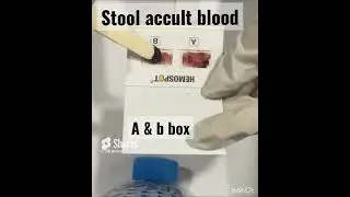 Stool occult blood test #laboratory #diagnosis #foryou #medical #youtubeshorts #viral #trending