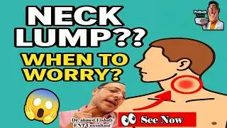 ⭐Swollen Lymph Nodes in Neck: Red Flags You Can’t Ignore 🚨 |ProHealthConsults