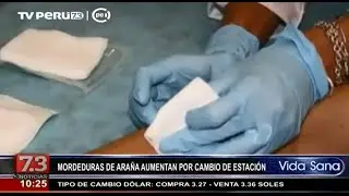 &iquest;C&oacute;mo reconocer la mordedura de una ara&ntilde;a?
