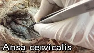 Ansa Cervicalis | Tips For NEET exam Preparation | neet pg preparation