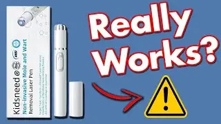 Kidsneed Laser Pen Review - Does it Work Or A Scam?