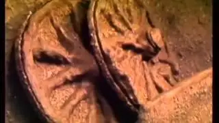 Archaeology Lindow Man British Museum 1985
