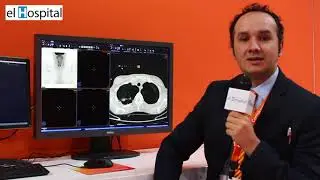 Novedades en sistemas RIS, PACS y soluciones HCIS