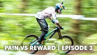 Hand and arm injuries in MTB. | Pain vs Reward E3