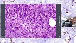 Rotina Anatomopatológica - Dermato-oncopato - 03/02
