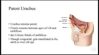 Congenital Anomalies of Urinary Bladder | Urinary Bladder | Dr. Saroj Mani Pokhrel