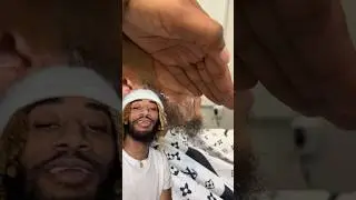 ASTONISHING Beard Unit Installation #shorts