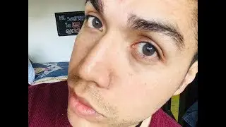 ELITE LENSES AGATE