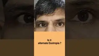 Is it alternate esotropia ?