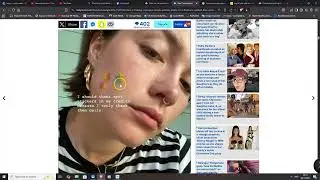 Starface pimple patches