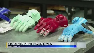 Indiana middle schoolers create prosthetic hand for classmate using 3-D printing