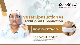 VASER Liposuction vs. Traditional Liposuction: Know the Difference | ZeroSize&reg; Grace Aesthetics Pune