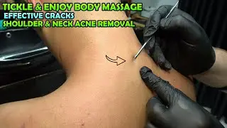 💈ASMR BARBER SHOULDER ACNE REMOVAL TREATMENT + CRACKS + Tickle Chest,Head,Belly,Foot & Body Massage
