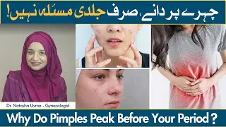 Why Do Pimples Peak Before Periods? | Acne Before Period | Period Se Pehle Pimples Kyun Hote Hain?