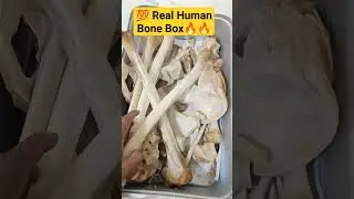 💯 Real Human Bone Box🔥🔥☑️ #humanskeleton #skeleton #humanbody #humanbones #anatomy #bone #bones ☑️☑️