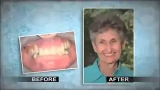 I forget that these are not the teeth I was born with