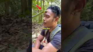 So &uuml;berlebst du einen Schlangenbiss! 😨