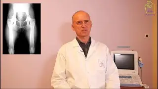 CMP Platany - DYSPLAZJA STAWU BIODROWEGO