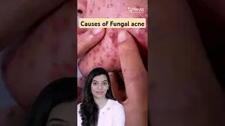 Fungal Acne: Why Does It Happen? #fungalacne #fungal #acne #skincare #shorts #drravali