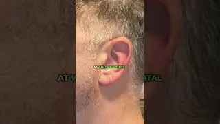 A Small Ear Fix That Changed Everything 👂✨