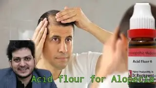 Homeopathic medicine  flouricum Acidum for alopecia | Live Dr kirti Vikram |