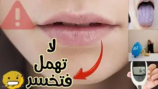 لون الشفاه أبيض ؟ معلومه قد تنقذ حياتك !