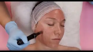 Dermapen微针价格表